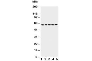 Western blot testing of p63 antbody