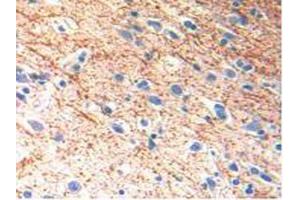 IHC-P analysis of Human Brain Tissue, with DAB staining. (IL-13 抗体  (AA 25-146))