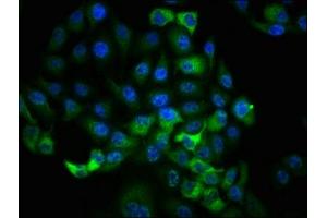 Immunofluorescence staining of Hela cells with ABIN7127744 at 1:100,counter-stained with DAPI. (Recombinant RPS6KA1 抗体  (pSer363, pThr359))