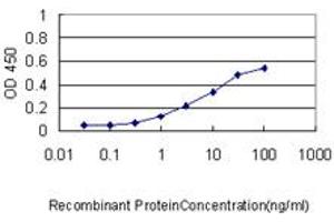 Detection limit for recombinant GST tagged RIPK4 is approximately 0. (RIPK4 抗体  (AA 675-784))