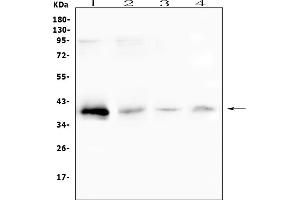 Western blot analysis of RP2 using anti-RP2 antibody (ABIN6719513).