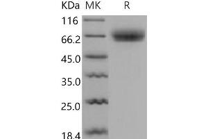 Western Blotting (WB) image for Osteomodulin (OMD) protein (His tag) (ABIN7320274) (Osteomodulin Protein (OMD) (His tag))