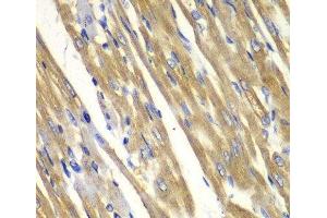Immunohistochemistry of paraffin-embedded Rat heart using TYR Polyclonal Antibody at dilution of 1:100 (40x lens). (TYR 抗体)