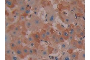 Detection of COX 2 in Human Liver Tissue using Polyclonal Antibody to Cyclooxygenase-2 (COX 2) (COX2 抗体  (AA 187-425))