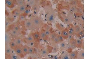 Detection of COX 2 in Human Liver Tissue using Polyclonal Antibody to Cyclooxygenase-2 (COX 2) (PTGS2 抗体  (AA 187-425))