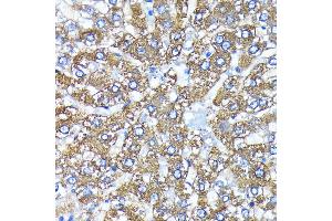 Immunohistochemistry of paraffin-embedded rat liver using  antibody (ABIN7265709) at dilution of 1:100 (40x lens). (ATG3 抗体)