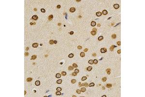 Immunohistochemistry of paraffin-embedded rat brain using LMNA antibody at dilution of 1:200 (x400 lens). (Lamin A/C 抗体)