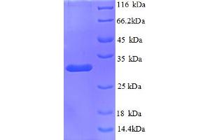 SDS-PAGE (SDS) image for Kininogen 1 (KNG1) (AA 390-644) protein (His tag) (ABIN5712930) (KNG1 Protein (AA 390-644) (His tag))