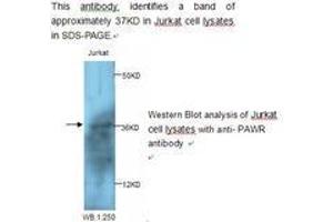 Image no. 1 for anti-PRKC, Apoptosis, WT1, Regulator (PAWR) antibody (ABIN790827) (PAWR 抗体)
