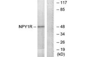 Western blot analysis of extracts from NIH-3T3 cells, using NPY1R Antibody. (NPY1R 抗体  (AA 221-270))
