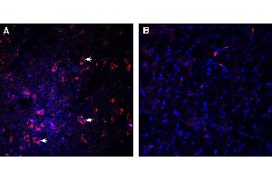 Expression of Dopamine Transporter (DAT) in rat substantia nigra pars compacta.