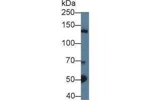 Western Blot; Sample: Mouse Cerebrum lysate; ;Primary Ab: 1µg/ml Rabbit Anti-Mouse HDAC4 Antibody;Second Ab: 0.