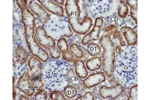Immunohistochemistry (IHC) image for anti-Potassium Inwardly-Rectifying Channel, Subfamily J, Member 16 (KCNJ16) (AA 311-325), (Intracellular) antibody (ABIN7043478)