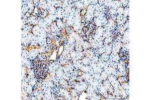 IHC analysis of CD31/Pecam1 using anti-CD31/Pecam1 antibody (ABIN7601662). (CD31 抗体  (AA 41-258))