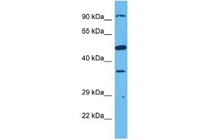 Host:  Rabbit  Target Name:  SUN1  Sample Tissue:  Human HCT116 Whole Cell  Antibody Dilution:  1ug/ml (SUN1 抗体  (N-Term))
