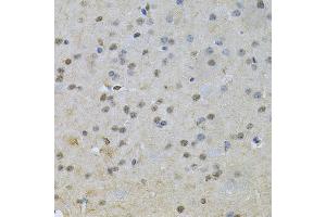 Immunohistochemistry of paraffin-embedded mouse brain using NRF1 Antibody (ABIN6290682) at dilution of 1:100 (40x lens). (NRF1 抗体)