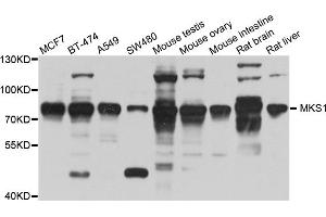 Western blot analysis of extracts of various cell lines, using MKS1 antibody (ABIN5995499) at 1/1000 dilution. (MKS1 抗体)