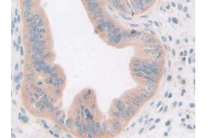 IHC-P analysis of Mouse Uterus Tissue, with DAB staining. (GDF5 抗体  (AA 358-495))