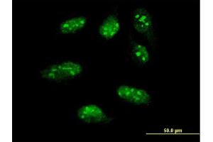 Immunofluorescence of monoclonal antibody to LHX1 on HeLa cell. (LHX1 抗体  (AA 1-100))