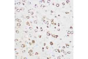 Immunohistochemistry of paraffin-embedded rat brain using NOMO1 Rabbit pAb (ABIN6128346, ABIN6144710, ABIN6144711 and ABIN6214793) at dilution of 1:350 (40x lens). (NOMO1 抗体  (AA 700-1000))