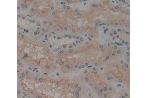 IHC-P analysis of Kidney tissue, with DAB staining. (CAMLG 抗体  (AA 19-184))