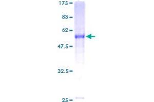 Image no. 1 for Oxidized Low Density Lipoprotein (Lectin-Like) Receptor 1 (OLR1) (AA 1-273) protein (GST tag) (ABIN1313384)