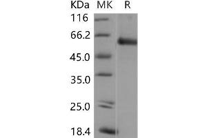 Western Blotting (WB) image for SMAD, Mothers Against DPP Homolog 5 (SMAD5) protein (ABIN7320167) (SMAD5 蛋白)
