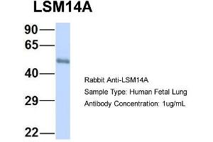 Host: Rabbit  Target Name: LSM14A  Sample Tissue: Human Fetal Lung  Antibody Dilution: 1. (LSM14A 抗体  (C-Term))