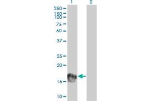Western Blot analysis of UBE2C expression in transfected 293T cell line by UBE2C monoclonal antibody (M01), clone 9D3. (UBE2C 抗体  (AA 70-179))