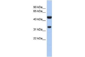 WB Suggested Anti-SULT1B1 Antibody Titration:  0.