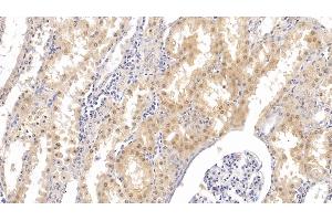 Detection of PTHR2 in Human Kidney Tissue using Monoclonal Antibody to Parathyroid Hormone Receptor 2 (PTHR2) (PTH2R 抗体  (AA 27-145))
