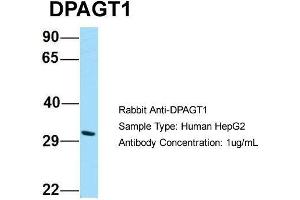 Western Blotting (WB) image for anti-Dolichyl-Phosphate (UDP-N-Acetylglucosamine) N-acetylglucosaminephosphotransferase 1 (GlcNAc-1-P Transferase) (DPAGT1) (C-Term) antibody (ABIN2790329)