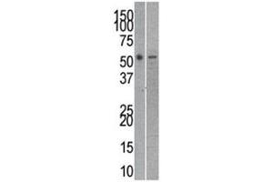 Reptin antibody used in western blot to detect RUVBL2 in mouse kidney (left) and SK-Br-3 (right) lysate (RUVBL2 抗体  (AA 400-430))