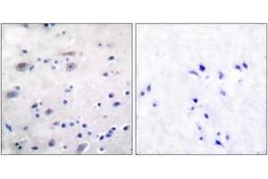 Immunohistochemistry analysis of paraffin-embedded human brain, using Opioid Receptor (Phospho-Ser375) Antibody. (Opioid Receptor (AA 341-390), (pSer377) 抗体)