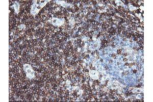 Image no. 1 for anti-CD3 epsilon (CD3E) antibody (ABIN1497222) (CD3 epsilon 抗体)