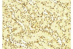 ABIN6268843 at 1/100 staining Mouse liver tissue by IHC-P. (NOTCH2 抗体)