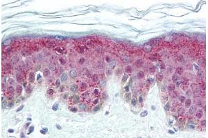 Human Skin (formalin-fixed, paraffin-embedded) stained with DNMT1 antibody ABIN305735 at 5 ug/ml followed by biotinylated anti-mouse IgG secondary antibody ABIN481714, alkaline phosphatase-streptavidin and chromogen.