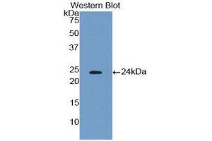 Western Blotting (WB) image for anti-Phospholipase A2, Group IVA (Cytosolic, Calcium-Dependent) (PLA2G4A) (AA 563-749) antibody (ABIN1174847) (PLA2G4A 抗体  (AA 563-749))