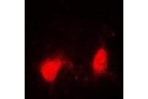 Immunofluorescent analysis of SSNA1 staining in A549 cells. (SSNA1 抗体)