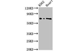 Western Blot Positive WB detected in: K562 whole cell lysate, Rat heart tissue All lanes: L3MBTL2 antibody at 3 μg/mL Secondary Goat polyclonal to rabbit IgG at 1/50000 dilution Predicted band size: 80, 70 kDa Observed band size: 70 kDa (L3MBTL2 抗体  (AA 1-230))