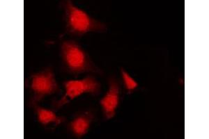 ABIN6267242 staining K562 by IF/ICC. (JAK2 抗体  (pTyr570))
