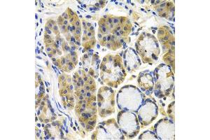 Immunohistochemistry of paraffin-embedded human colon carcinoma using APBB1 antibody (ABIN5971004) at dilution of 1/100 (40x lens). (FE65 抗体)