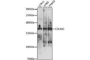Western blot analysis of extracts of various cell lines, using COL4 antibody (ABIN6130196, ABIN6138845, ABIN6138846 and ABIN6225111) at 1:1000 dilution. (COL4a5 抗体  (AA 1462-1691))