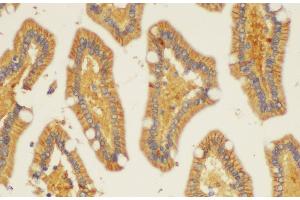 Immunohistochemistry of paraffin-embedded Human duodenum using ST14 Ployclonal Antibody at dilution of 1:200. (ST14 抗体)