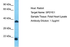 Host: Rabbit Target Name: SPDYE1 Sample Type: Fetal Heart lysates Antibody Dilution: 1. (SPDYE1 抗体  (N-Term))