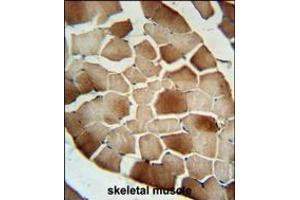 CFB Antibody immunohistochemistry analysis in formalin fixed and paraffin embedded human skeletal muscle followed by peroxidase conjugation of the secondary antibody and DAB staining. (Complement Factor B 抗体  (AA 469-494))