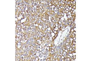 Immunohistochemistry (IHC) image for anti-Catenin (Cadherin-Associated Protein), beta 1, 88kDa (CTNNB1) antibody (ABIN7266137)