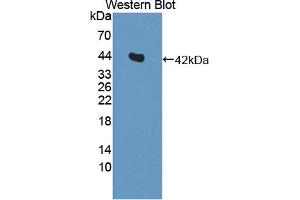 Western blot analysis of the recombinant protein. (IL11RA 抗体  (AA 24-371))