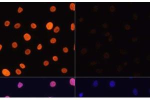 Immunofluorescence analysis of C6 cells using Acetyl-Histone H3-K4 Polyclonal Antibody at dilution of 1:100.