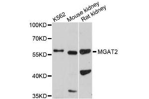 Western blot analysis of extracts of various cell lines, using MGAT2 antibody (ABIN5996502) at 1/1000 dilution. (MGAT2 抗体)